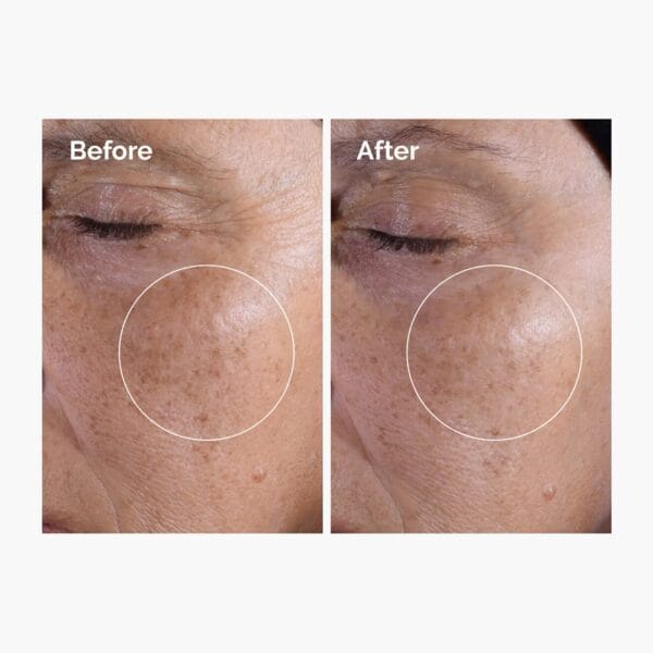 img_8835 THE ORDINARY Glycolic Acid 7% Exfoliating Toner 240Ml